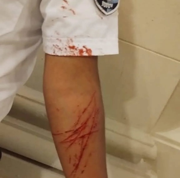 Un policía resultó herido tras enfrentar a un delincuente que sustrajo un celular