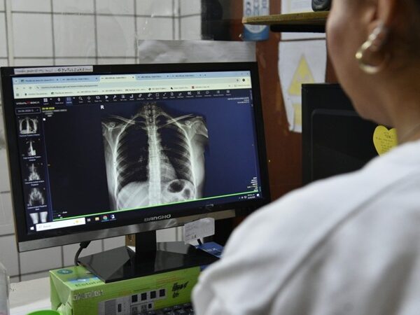 Jujuy dispone de exámenes digitalizados en toda la red pública de salud